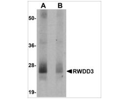 Anti-RWDD3 antibody produced in rabbitaffinity isolated antibody, buffered aqueous solution, ab2