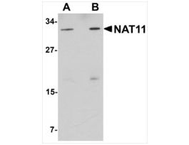 Anti-NAT11 antibody produced in rabbitaffinity isolated antibody, buffered aqueous solution
