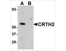 Anti-CRTH2 antibody produced in rabbitaffinity isolated antibody, buffered aqueous solution