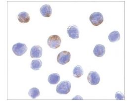 Anti-DDX3 antibody produced in rabbitaffinity isolated antibody, buffered aqueous solution