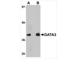 Anti-GATA3 antibody produced in rabbitaffinity isolated antibody, buffered aqueous solution
