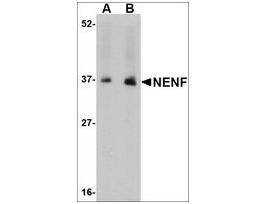 Anti-NENF antibody produced in rabbitaffinity isolated antibody, buffered aqueous solution