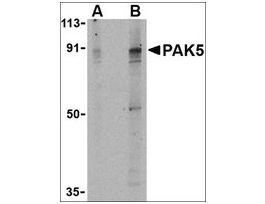 Anti-PAK5 antibody produced in rabbitaffinity isolated antibody, buffered aqueous solution