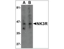 Anti-NK3R antibody produced in rabbitaffinity isolated antibody, buffered aqueous solution