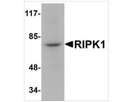 Anti-RIPK1 antibody produced in rabbitaffinity isolated antibody, buffered aqueous solution