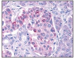 Anti-IKKepsilon antibody produced in rabbitaffinity isolated antibody, buffered aqueous solution