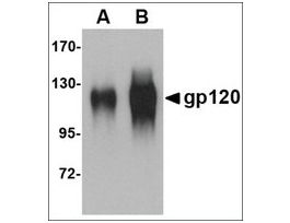Anti-gp120 antibody produced in goataffinity isolated antibody, buffered aqueous solution