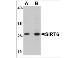 Anti-SIRT6 antibody produced in chickenaffinity isolated antibody, buffered aqueous solution