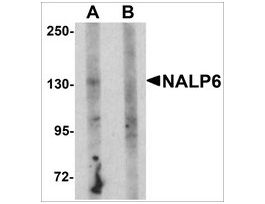 Anti-NALP6 antibody produced in rabbitaffinity isolated antibody, buffered aqueous solution