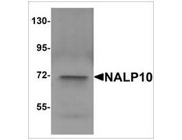 Anti-NALP10 antibody produced in rabbitaffinity isolated antibody, buffered aqueous solution