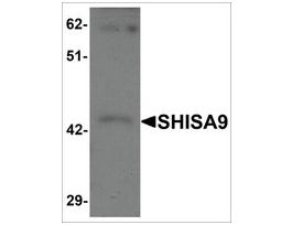 Anti-SHISA9 antibody produced in rabbitaffinity isolated antibody, buffered aqueous solution