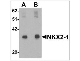 Anti-NKX2-1 antibody produced in rabbitaffinity isolated antibody