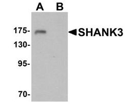 Anti-SHANK3 antibody produced in rabbitaffinity isolated antibody, buffered aqueous solution