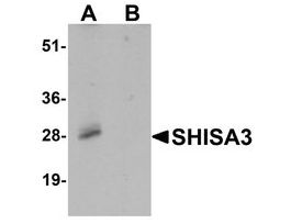 Anti-SHISA3 antibody produced in rabbitaffinity isolated antibody, buffered aqueous solution