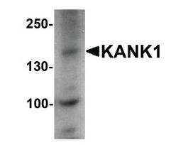 Anti-KANK1 antibody produced in rabbitaffinity isolated antibody, buffered aqueous solution