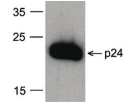 Monoclonal Anti-HIV-1 P26 antibody produced in mouseaffinity isolated antibody