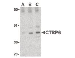 Anti-CTRP6 antibody produced in rabbitaffinity isolated antibody