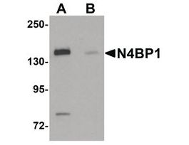 Anti-N4BP1 antibody produced in rabbitaffinity isolated antibody