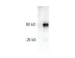 Anti-Rabbit IgG (H+L), highly cross adsorbed-Peroxidase antibody produced in goatIgG fraction of antiserum, lyophilized powder