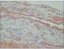 Anti-TDP-43 (N-terminal region) antibody produced in rabbit~1.0 mg/mL, affinity isolated antibody, buffered aqueous solution