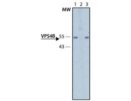 Anti-VPS4B antibody produced in rabbit~1.0 mg/mL, affinity isolated antibody, buffered aqueous solution