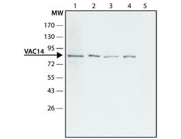 Anti-VAC14 antibody produced in rabbit~1.5 mg/mL, affinity isolated antibody, buffered aqueous solution