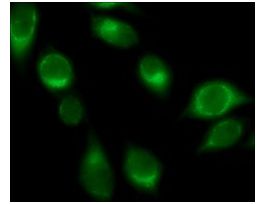 Anti-Rab32 antibody produced in rabbit~1.0 mg/mL, affinity isolated antibody