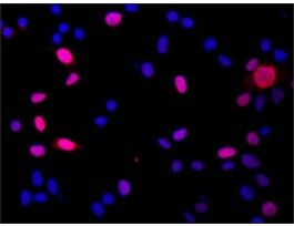 Anti-DGCR8 (N-terminal) antibody produced in rabbit~1.0 mg/mL, affinity isolated antibody