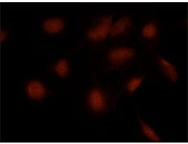 Anti-SMAD7 (N-terminal) antibody produced in rabbit~1.0 mg/mL, affinity isolated antibody, western blot: 2 mug/mL