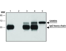 Anti-SMAD6 (C-terminal) antibody produced in rabbit~1.0 mg/mL, affinity isolated antibody