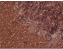 Monoclonal Anti-Neuron-Specific Enolase (NSE) antibody produced in mouse~1.0 mg/mL, clone NSE-P2, affinity isolated antibody