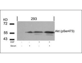 Anti-phospho-AKT1 (pSer473) antibody produced in rabbitaffinity isolated antibody