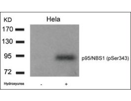 Anti-phospho-NBN (pSer343) antibody produced in rabbitaffinity isolated antibody