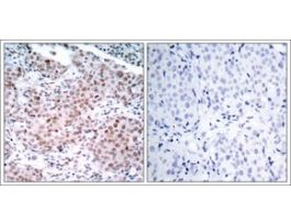 Anti-phospho-ESR1 (pSer104) antibody produced in rabbitaffinity isolated antibody