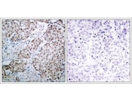 Anti-phospho-TP53 (pSer315) antibody produced in rabbitaffinity isolated antibody