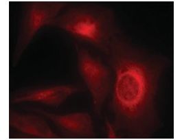 Anti-phospho-HSPB1 (pSer15) antibody produced in rabbitaffinity isolated antibody
