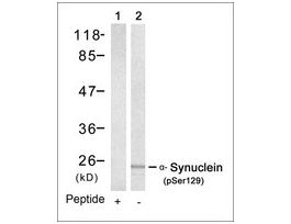 Anti-phospho-SNCA (pSer129) antibody produced in rabbitaffinity isolated antibody