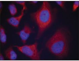 Anti-phospho-ADD1 (pSer726) antibody produced in rabbitaffinity isolated antibody
