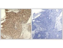Anti-phospho-HDAC2 (pSer394) antibody produced in rabbitaffinity isolated antibody