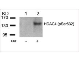 Anti-phospho-HDAC4 (pSer632) antibody produced in rabbitaffinity isolated antibody