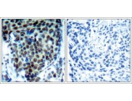 Anti-phospho-MAPK14 (pThr180) antibody produced in rabbitaffinity isolated antibody