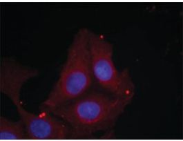 Anti-phospho-GAP43 (pSer41) antibody produced in rabbitaffinity isolated antibody
