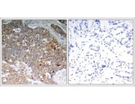 Anti-phospho-GSK3B (pTyr216) antibody produced in rabbitaffinity isolated antibody