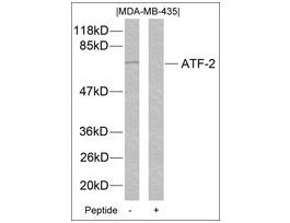 Anti-ATF2 (Ab-112 or 94) antibody produced in rabbitaffinity isolated antibody
