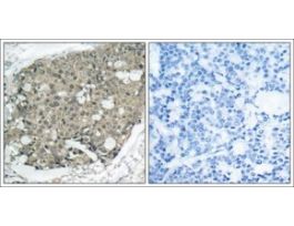 Anti-AKT1 (Ab-308) antibody produced in rabbitaffinity isolated antibody