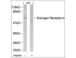 Anti-ESR1 (Ab-104) antibody produced in rabbitaffinity isolated antibody