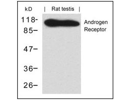 Anti-AR (Ab-650) antibody produced in rabbitaffinity isolated antibody