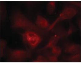 Anti-PAK1/PAK2/PAK3 (Ab-423/402/421) antibody produced in rabbitaffinity isolated antibody