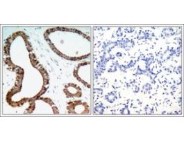 Anti-YWHAZ (Ab-58) antibody produced in rabbitaffinity isolated antibody
