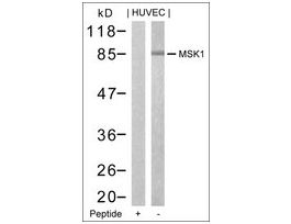 Anti-RPS6KA5 (Ab-376) antibody produced in rabbitaffinity isolated antibody